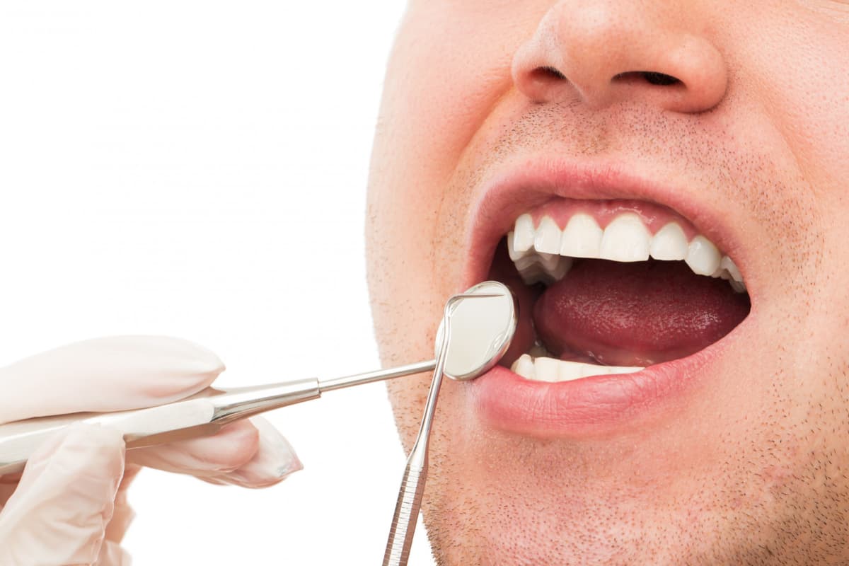 Tooth Extraction